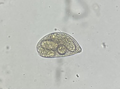 Erysiphe liriodendri