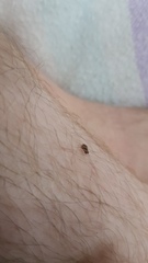 Siphonaptera