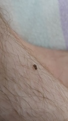 Siphonaptera