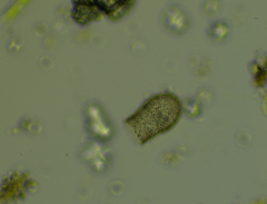 Codonella cratera