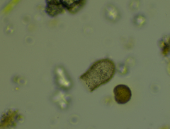 Codonella cratera