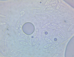 Arachnopeziza trabinelloides