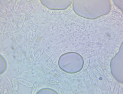 Arachnopeziza trabinelloides
