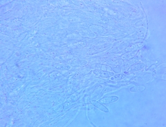 Arachnopeziza trabinelloides
