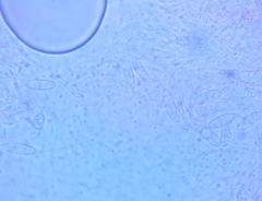 Arachnopeziza trabinelloides