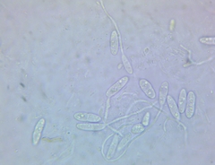 Arachnopeziza trabinelloides