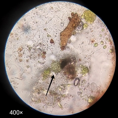 Pseudopediastrum