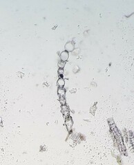 Subsecunda
