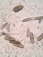 Phaeodiaporthe appendiculata