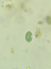 Glaucocystis