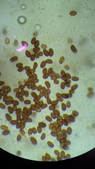 Coprinellus xanthothrix