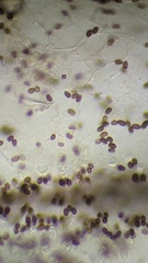 Coprinellus xanthothrix