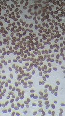 Coprinellus xanthothrix