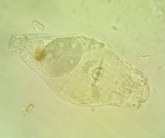 Bdelloidea