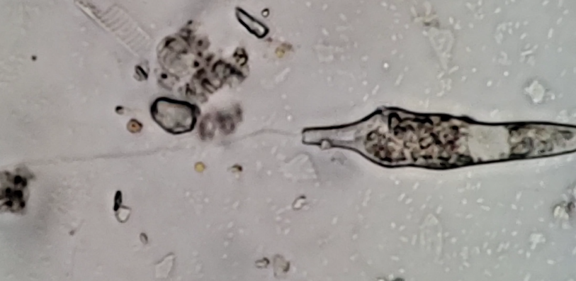 Chasmostoma nieuportense