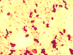 Azotobacter chroococcum