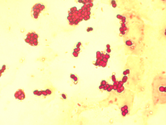 Azotobacter chroococcum