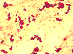 Azotobacter chroococcum
