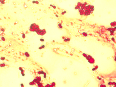 Azotobacter chroococcum