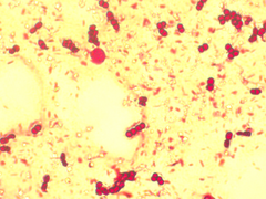 Azotobacter chroococcum