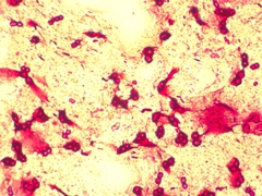 Azotobacter chroococcum