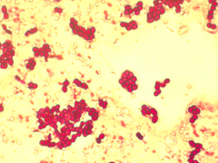 Azotobacter chroococcum