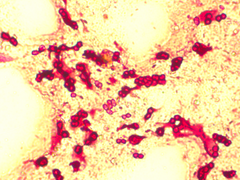 Azotobacter chroococcum