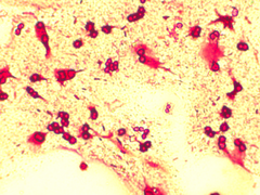Azotobacter chroococcum