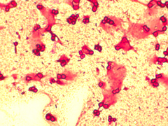 Azotobacter chroococcum