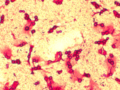 Azotobacter chroococcum