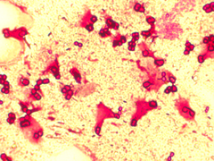 Azotobacter chroococcum