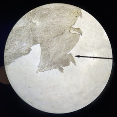 Mucronella bresadolae