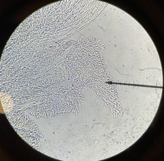 Mucronella bresadolae