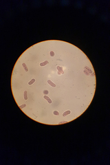 Chromatium okenii