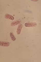 Chromatium okenii
