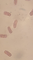 Chromatium okenii