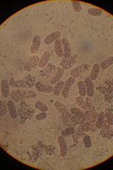 Chromatium okenii