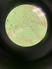 Escherichia coli