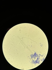 Escherichia coli