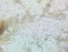 Rosellinia corticium