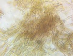 Rosellinia corticium