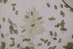 Melanconis stilbostoma