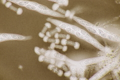 Melanconis stilbostoma