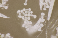 Melanconis stilbostoma