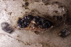 Melanconis stilbostoma