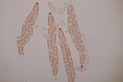 Melanconis stilbostoma