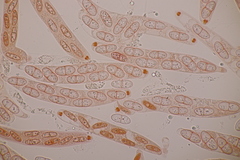 Melanconis stilbostoma
