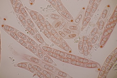 Melanconis stilbostoma