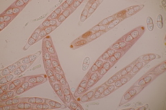 Melanconis stilbostoma