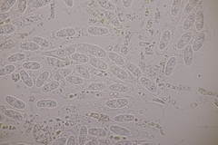 Melanconis stilbostoma